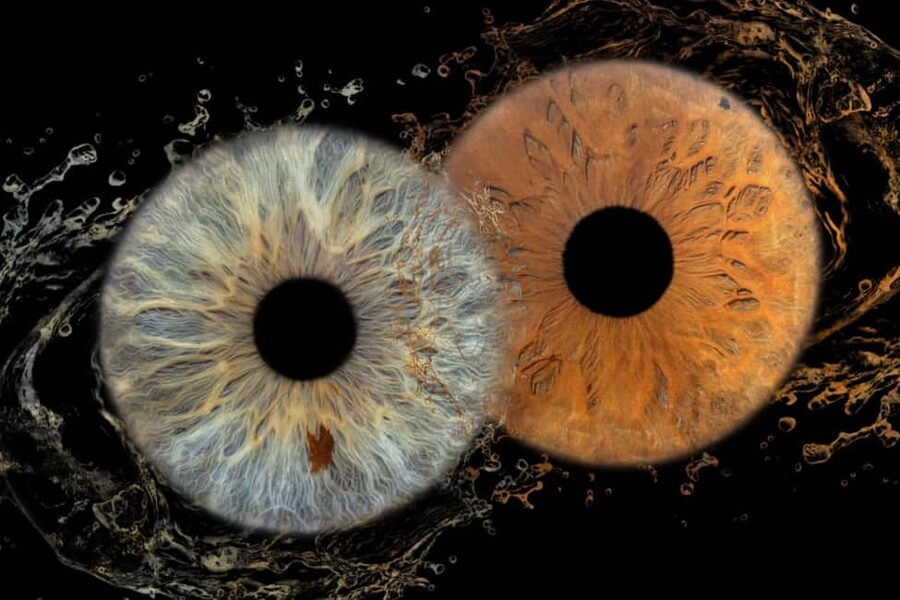 IRIS Photography (macro photo of your eye) - Key highlights you should care about